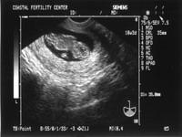 5/28/05
Baby B - 10w3d