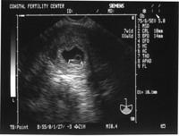 5/3/05
Baby B - 7w1d